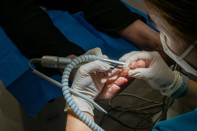 podolog Gdańsk - specjalistka podologii wykonuje zabieg na paznokciu klienta - czy podolog daje znieczulenie